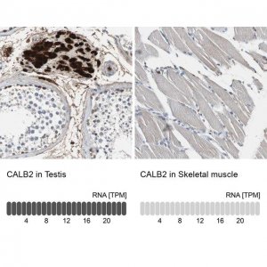 Anti-CALB2 antibody produced in rabbit 