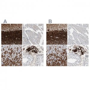 Anti-CALB2 antibody produced in rabbit 