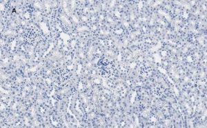 Anti-Calbindin D-28K clone 1A11 Antibody, ZooMAb Rabbit Monoclonal 