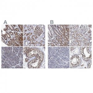 Anti-CALCOCO2 antibody produced in rabbit 