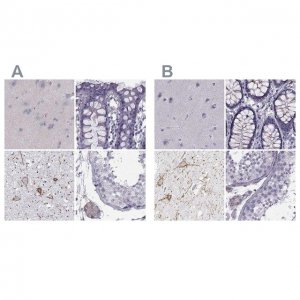 Anti-CALCR antibody produced in rabbit 