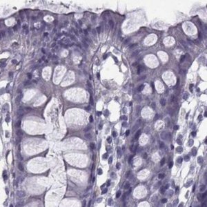 Anti-CALCR antibody produced in rabbit 