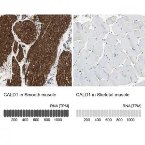 Anti-CALD1 antibody produced in rabbit 
