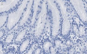Anti-Calpain-9 Antibody, clone 1J22 ZooMAb Rabbit Monoclonal 