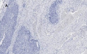 Anti-Calponin 1 Antibody, clone 9D14, ZooMAb Rabbit Monoclonal 