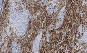 Anti-Calponin 1 Antibody, clone 9D14, ZooMAb Rabbit Monoclonal 