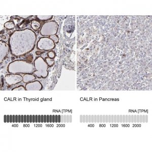 Anti-CALR antibody produced in rabbit HPA002242-100UL