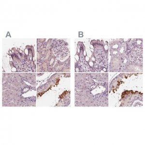 Anti-CALR3 antibody produced in rabbit 