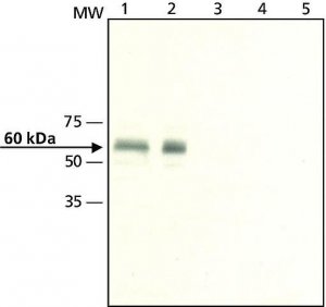 Anti-Calsequestrin-1 antibody produced in rabbit C0618-200UL