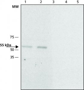 Anti-Calsequestrin-2 antibody produced in rabbit 