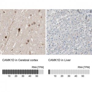 Anti-CAMK1D antibody produced in rabbit 