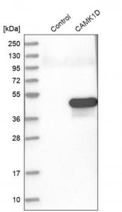 Anti-CAMK1D antibody produced in rabbit 