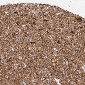 Anti-CAMK2B antibody produced in rabbit 