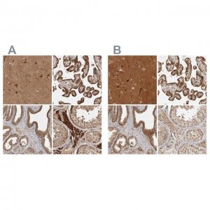 Anti-CAMSAP2 antibody produced in rabbit 