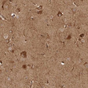 Anti-CAMSAP2 antibody produced in rabbit 