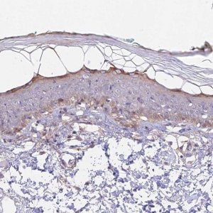 Anti-CAMSAP3 antibody produced in rabbit 
