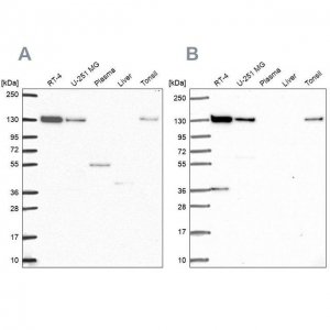 Anti-CAND1 antibody produced in rabbit HPA055748-100UL