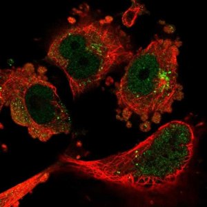 Anti-CAND1 antibody produced in rabbit HPA055748-100UL