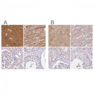 Anti-CAP2 antibody produced in rabbit 