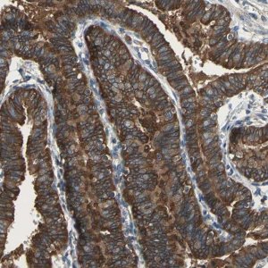 Anti-CAPN1 antibody produced in rabbit 