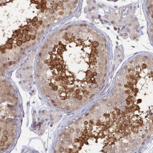 Anti-CAPN11 antibody produced in rabbit 