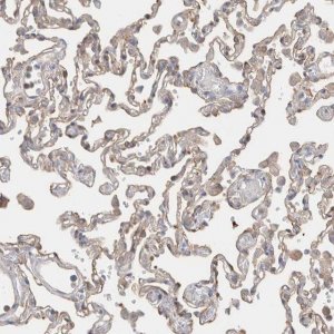 Anti-CAPN2 antibody produced in rabbit 
