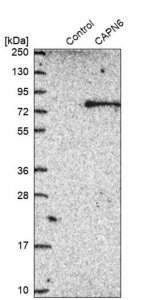 Anti-CAPN6 antibody produced in rabbit 