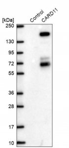 Anti-CARD11 antibody produced in rabbit 