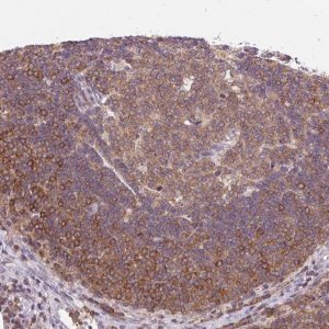 Anti-CARD11 antibody produced in rabbit 