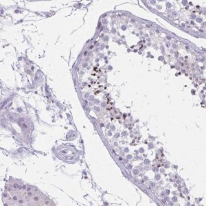 Anti-CARD9 antibody produced in rabbit 