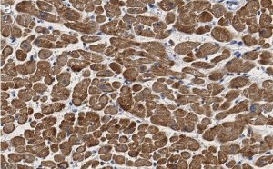 Anti-Cardiac Troponin I Antibody, clone 1F23, ZooMAb Rabbit Monoclonal 