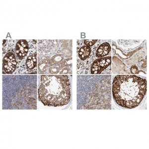 Anti-CARMIL1 antibody produced in rabbit 