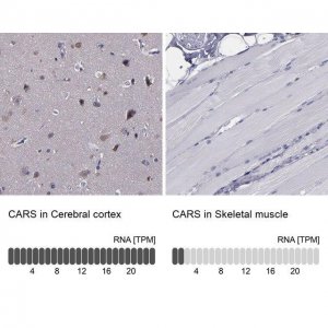 Anti-CARS antibody produced in rabbit 