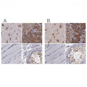 Anti-CARS antibody produced in rabbit 