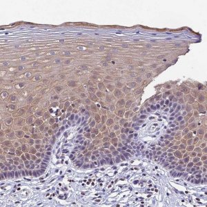 Anti-CARS2 antibody produced in rabbit 