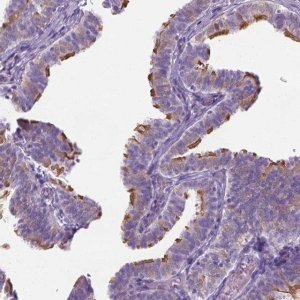 Anti-CASC1 antibody produced in rabbit 