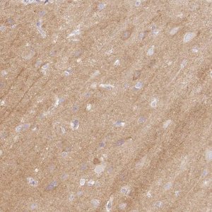 Anti-CASKIN1 antibody produced in rabbit 
