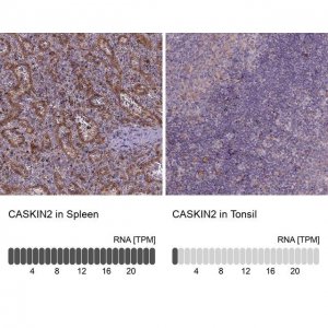 Anti-CASKIN2 
