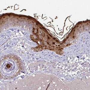 Anti-CASP14 antibody produced in rabbit 