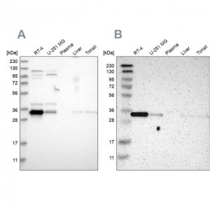 Anti-CASP6 antibody produced in rabbit 