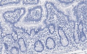 Anti-Caspase-1 (p20) Antibody, clone 2G4 , ZooMAb Rabbit Monoclonal 