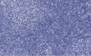 Anti-Caspase-1 p10 Antibody, clone 9H11 ZooMAb Rabbit Monoclonal 