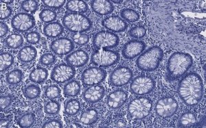 Anti-Caspase-8 Antibody, clone 1L15 ZooMAb Rabbit Monoclonal 