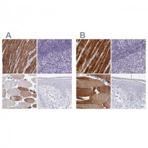 Anti-CASQ2 antibody produced in rabbit 