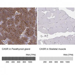 Anti-CASR antibody produced in rabbit 