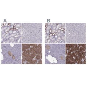 Anti-CASR antibody produced in rabbit 