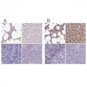 Anti-CAT antibody produced in rabbit 