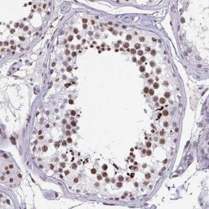 Anti-CBFA2T2 antibody produced in rabbit HPA060523-100UL