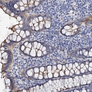 Anti-CBFB antibody produced in rabbit 