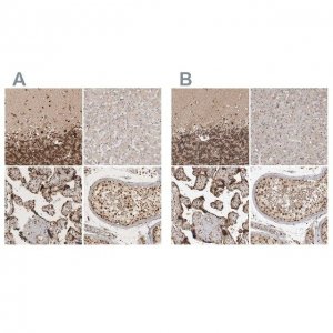 Anti-CBLL1 antibody produced in rabbit 